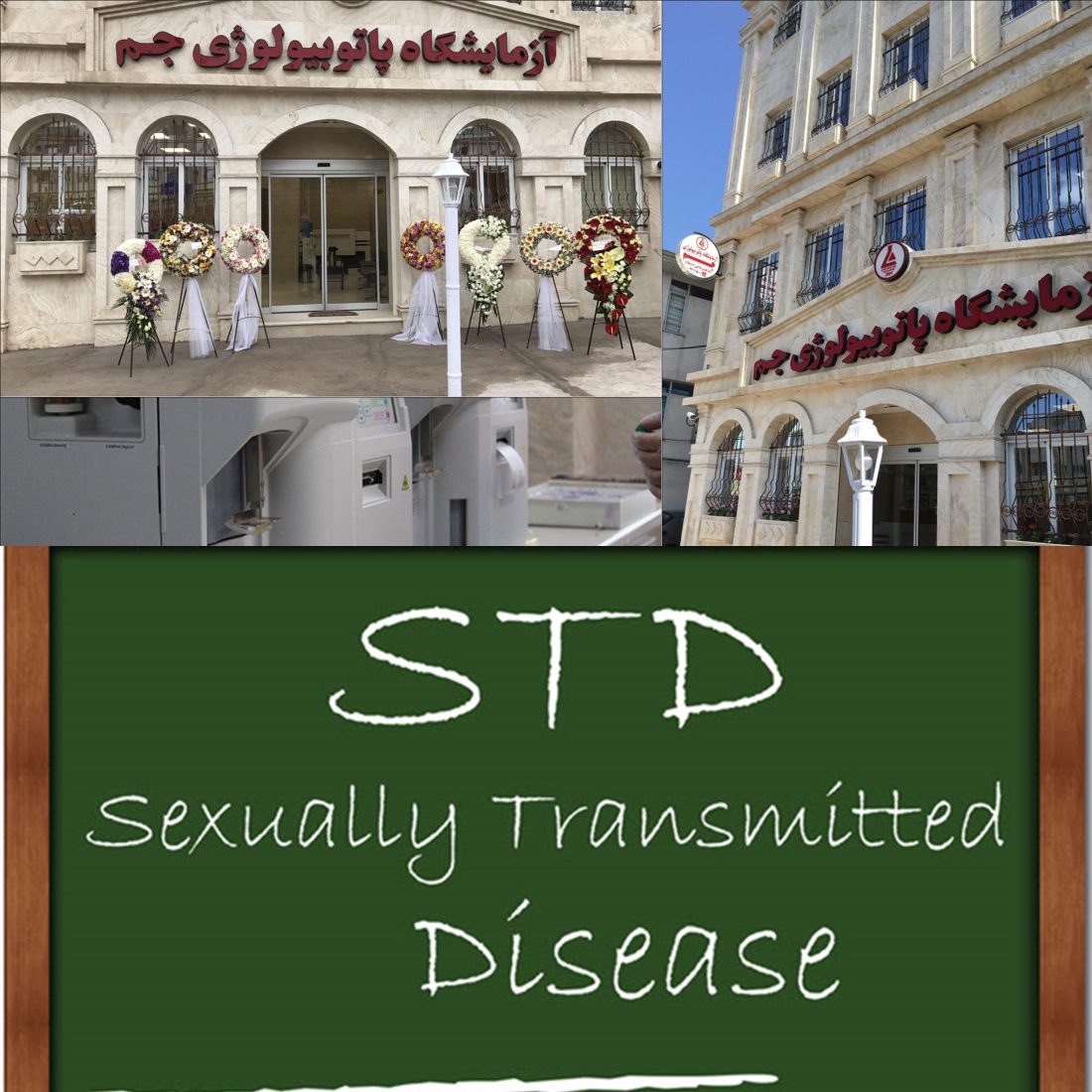 STDs